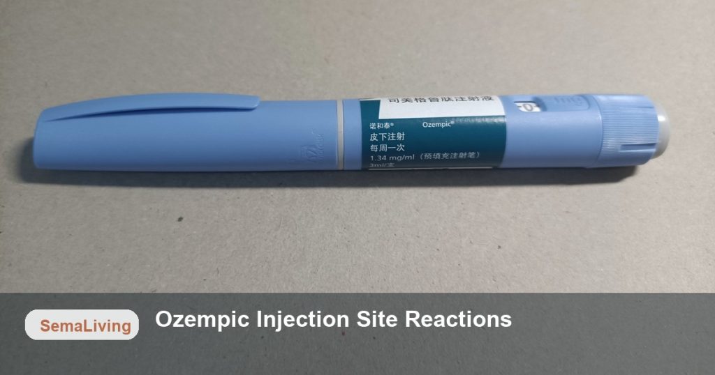 Ozempic Injection Site Reactions — SemaLiving article image